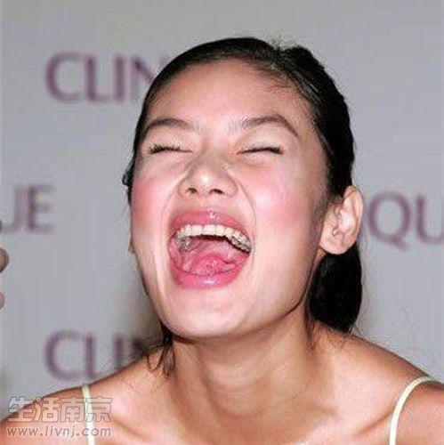 明星有哪些蛀牙,揭秘明星口腔健康问题